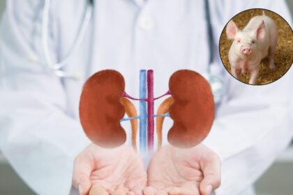 Kidneys Transplant : डुकराचे मूत्रपिंड मानवी शरीरात प्रत्ययापणच Clinical Trial यशस्वी